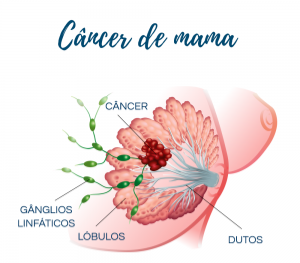 Biopsia de mama